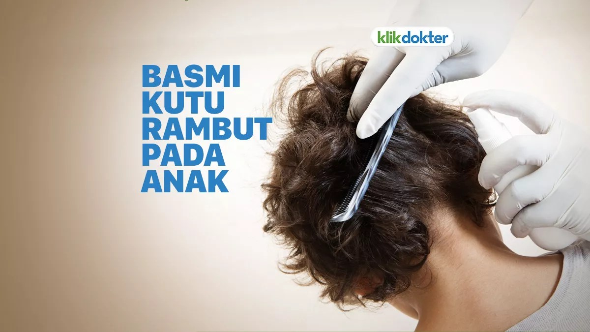 Cara menghilangkan kutu rambut