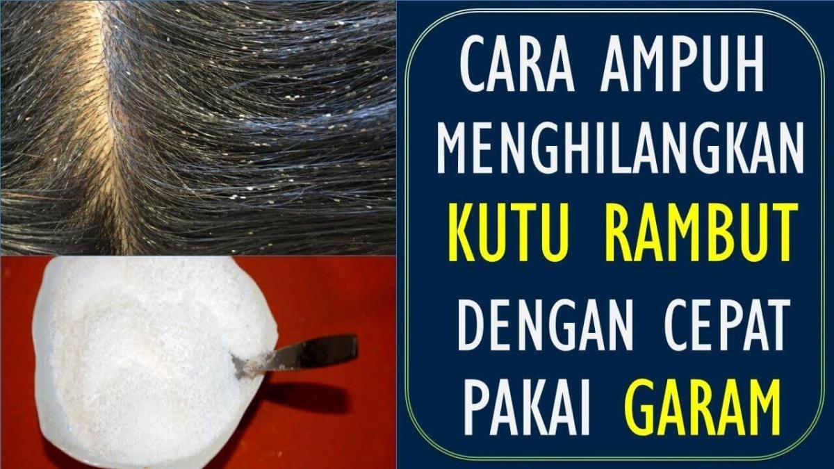 Kutu rambut manusia gejala mengatasinya membuat menghilangkan kepala alodokter gatal kulit dapat penyebab terlihat juga sehat haar plan restoration